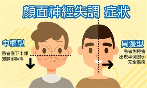 右臉頰|右臉麻麻的神經外科問題：可能是何種疾病？